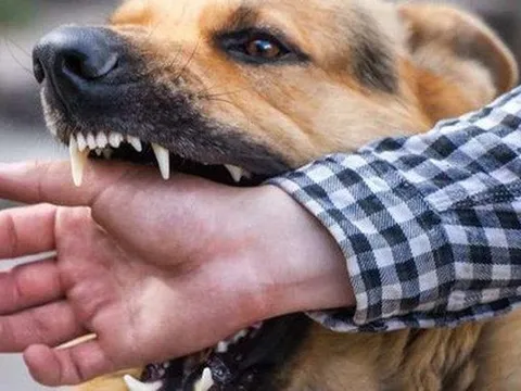 Người đàn ông tử vong sau 2 tháng bị chó cắn