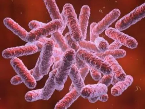 Bộ Y tế khuyến cáo 7 biện pháp phòng bệnh Whitmore