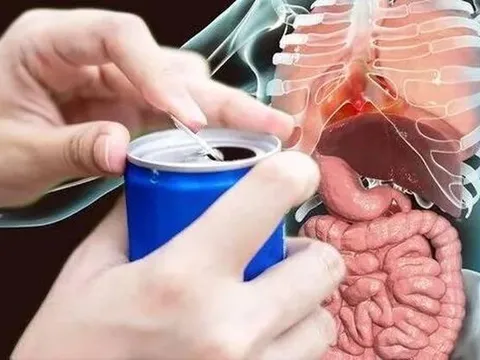 WHO liệt kê những nguy hiểm khi tiêu thụ nhiều nước tăng lực, từ răng miệng đến viêm gan cấp tính