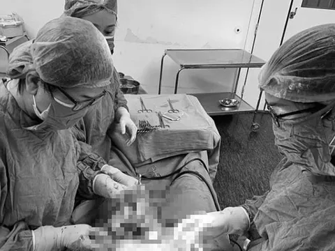 Hi hữu 50 triệu ca mới gặp 1: Người phụ nữ trẻ sinh thai đôi từ 2 tử cung