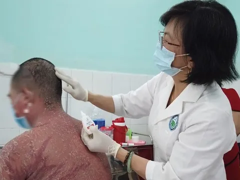 Nhiều trường hợp nhập viện do sử dụng thuốc chữa vảy nến mua trên mạng