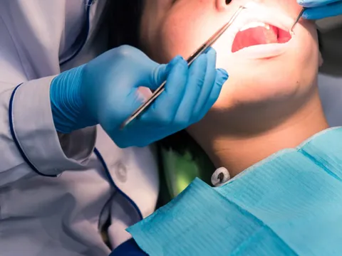 WHO: Gần 50% dân số thế giới mắc bệnh về răng miệng