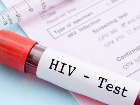 Nhiều giải pháp hướng tới chấm dứt dịch bệnh AIDS vào năm 2030