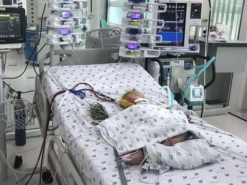 Bé 7 tháng tuổi co giật, suy hô hấp do mắc sốt xuất huyết
