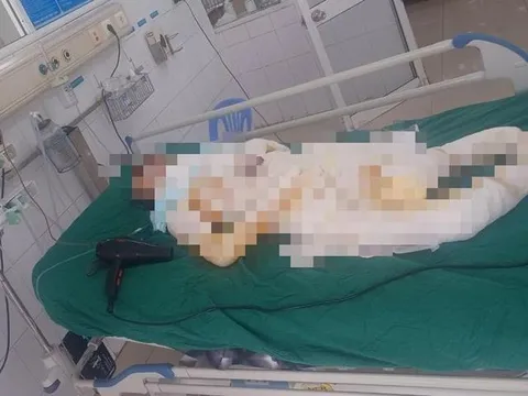 Vụ con đốt nhà mẹ: Sau nhiều lần phẫu thuật ghép da, sức khỏe người mẹ rất yếu