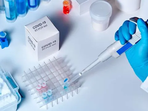 Số ca mắc Covid-19 giảm xuống mức thấp kỷ lục trong hơn 1 năm qua