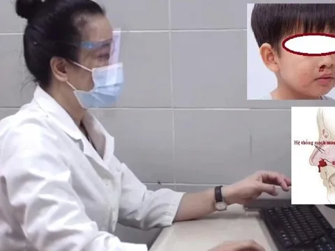 Chảy máu cam mùa đông, có nên lo lắng hay không?