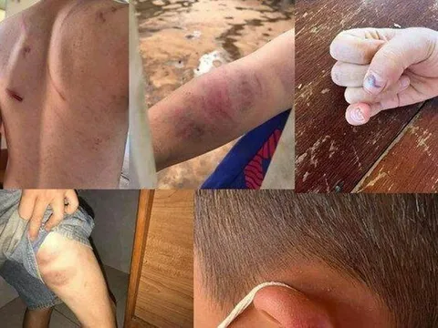 Những vụ bạo hành trẻ em rúng động dư luận năm 2022