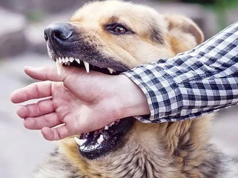 Nam thanh niên tử vong sau 4 tháng bị chó cắn
