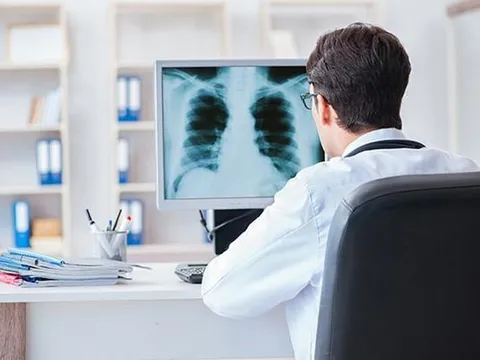 Lý do ngày càng nhiều người trẻ bị ung thư và cách phòng ngừa