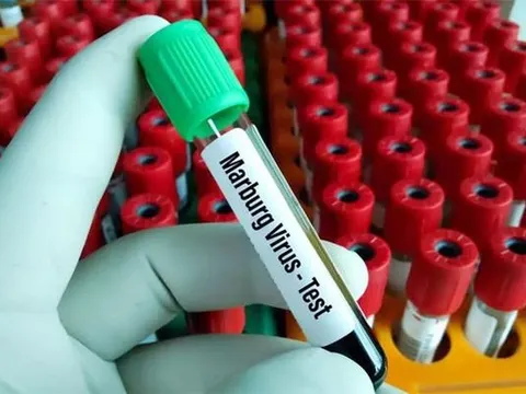 Ngành y tế TPHCM khuyến cáo người dân cảnh giác với virus Marburg