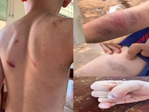 Tăng cường công tác phòng, chống bạo lực, xâm hại trẻ em