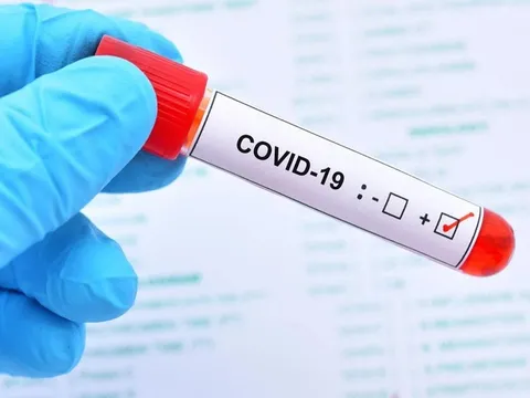 Cảnh báo về biến thể làm tăng nguy cơ bùng phát đợt dịch Covid-19 mới