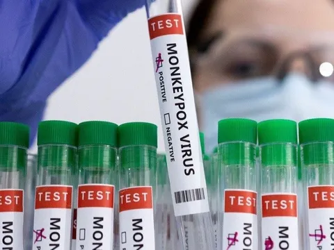 Dạng đậu mùa khỉ đặc biệt nghiêm trọng ở bệnh nhân HIV giai đoạn cuối