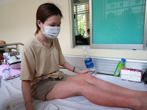 Những lưu ý khi chăm sóc trẻ mắc sốt xuất huyết tại nhà