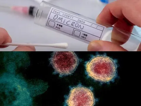 Chuyên gia cảnh báo người dân cần nâng cao biện pháp dự phòng cá nhân, tiêm mũi vaccine nhắc lại để giảm số ca mắc