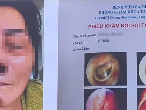 Hà Nội: 2 ca hoại tử xương hàm nặng trên nền đái tháo đường tử vong sau mắc COVID-19