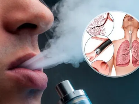 Bộ Y tế không đồng ý thí điểm kinh doanh thuốc lá mới bởi có hại cho sức khỏe