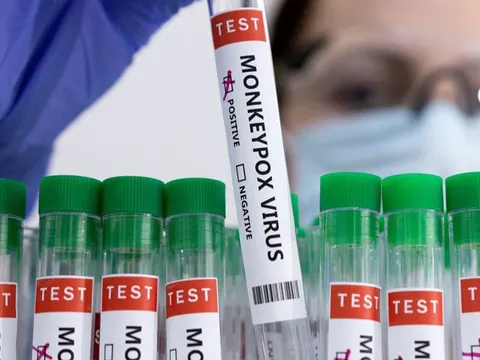 Sở Y tế TP HCM thông tin về một số vấn đề dư luận quan tâm