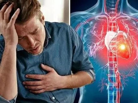 Số bệnh nhân tim mạch và các tai biến đang có chiều hướng gia tăng và trẻ hóa