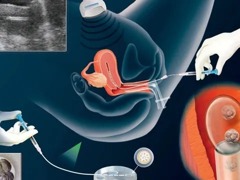 Tăng cường phòng chống vi phạm pháp luật về thụ tinh trong ống nghiệm và mang thai hộ vì mục đích nhân đạo