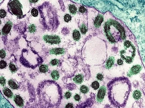 Nguy cơ lây nhiễm của virus Marburg như thế nào?