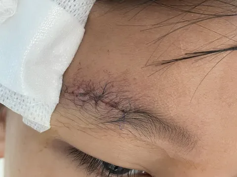 Cảnh báo trẻ nhỏ hiếu động có thể gây ra tai nạn đe dọa tính mạng do nghịch súng tự chế