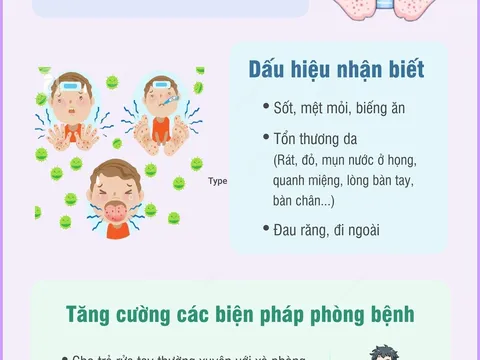 Sớm nhận biết dấu hiệu bệnh tay chân miệng để xử trí kịp thời