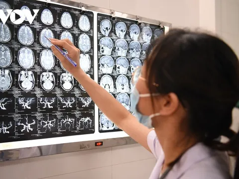 Triệu chứng tương đồng giữa u não và nhiễm sán lợn trên não