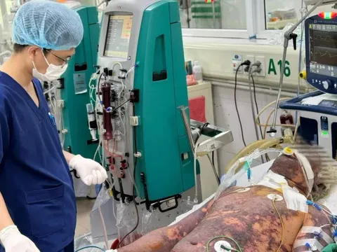 Người dân nên ăn chín, uống sôi để phòng bệnh liên cầu khuẩn lợn