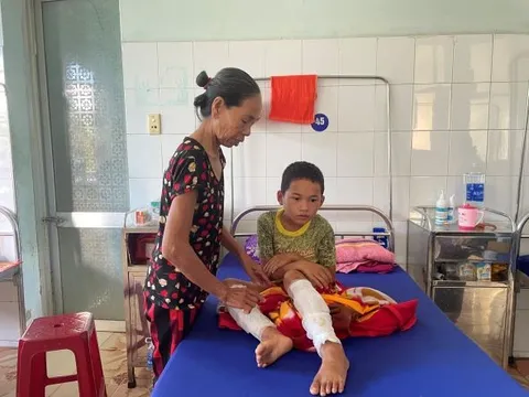 Quảng Bình: Phát hiện con trộm tiền, cha dùng xăng đốt con đẻ 8 tuổi